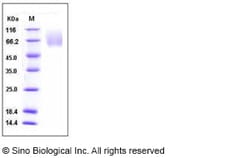 Sino Biological Human CEACAM1 / CD66a Protein (ECD, His Tag) 100ug, Quantity: