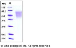 Sino Biological Recombinant Human CEACAM-6/CD66c Protein (His Tag), HPLC-verified,