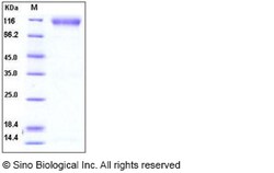 Sino Biological Recombinant Human FGFR2 Protein (His & hFc Tag), HPLC-verified,
