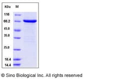 Sino Biological Recombinant Human FGFR2 Protein (aa 400-821, His & GST