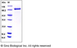 Sino Biological Recombinant Human Lyn Protein (GST Tag), Quantity: Each