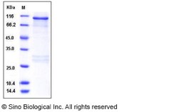 Sino Biological Recombinant Human RSK3 Protein (GST Tag), Quantity: Each