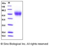 Sino Biological Recombinant Human SLAM/CD150 Protein (His Tag), HPLC-verified,