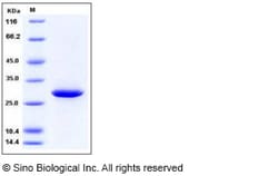 Sino Biological Human 14-3-3 sigma / Stratifin / YWHAS Protein 100ug, Quantity: