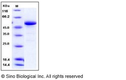 Sino Biological Human 14-3-3 epsilon / YWHAE Protein (GST Tag) 100ug, Quantity: