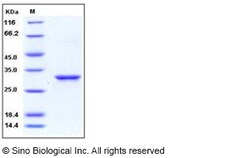 Sino Biological Recombinant Human 14-3-3 epsilon Protein, Quantity: Each