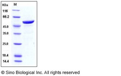 Sino Biological Recombinant Human 14-3-3 beta Protein (GST Tag), Quantity: