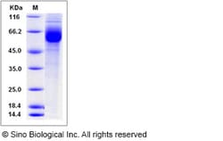 Sino Biological Recombinant Human GPR114 Protein (hFc Tag), Quantity: Each