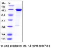 Sino Biological Recombinant Human HDAC8 Protein (GST Tag), Quantity: Each