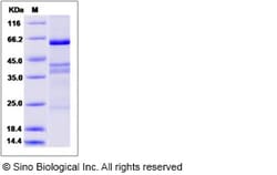 Sino Biological Human EGFL6 / EGF-L6 Protein (His Tag) 50ug, Quantity: