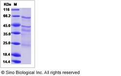 Sino Biological Human EGFL6 / EGF-L6 Protein (Flag & His Tag) 100ug, Quantity: