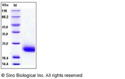 Sino Biological Human LAIR2 / CD306 Protein (His Tag) 100ug, Quantity: