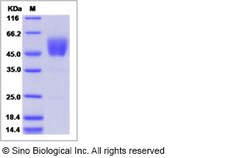 Sino Biological Human ALK-7 / ACVR1C Protein (ECD, Fc Tag) 200ug, Quantity:
