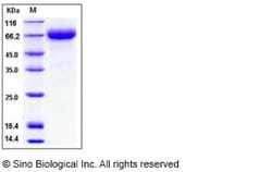 Sino Biological Human Hemopexin / HPX Protein (His Tag) 100ug, Quantity:
