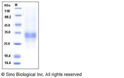 Sino Biological Recombinant Human TNFR1/CD120a Protein (His Tag), HPLC-verified,