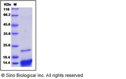 Sino Biological Recombinant Human CXCL4/PF4 Protein, Quantity: Each of