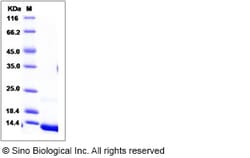 Sino Biological Recombinant Human CXCL7/NAP-2 Protein (His Tag), Quantity:
