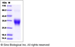 Sino Biological Recombinant Human Ephrin B2 Protein, Quantity: Each of