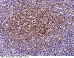 Sino Biological CD200 Antibody, Rabbit MAb 100uL, Quantity: Each of 1