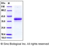 Sino Biological Recombinant Human Ephrin-B1 Protein (His Tag), Quantity: