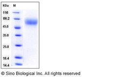 Sino Biological Human IL17RA / CD217 Protein (ECD, His Tag) 100ug, Quantity: