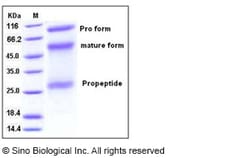 Sino Biological Human ADAM12 Protein (His Tag) 20ug, Quantity: Each of