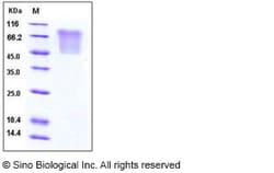 Sino Biological Recombinant Human CCL5/RANTES Protein (His & mucin Tag),