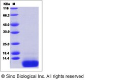 Sino Biological Human CCL5 / RANTES Protein 20ug, Quantity: Each of 1