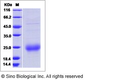 Sino Biological Recombinant Human Chorionic Gonadotropin/CGA Protein, Quantity: