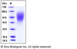 Sino Biological Recombinant Human OSTM1 Protein (His Tag), Quantity: Each