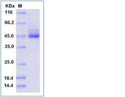 Sino Biological Recombinant Human TIGIT Protein (ECD, hFc Tag), HPLC-verified,