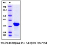 Sino Biological Recombinant Human Histone H1 Protein (His Tag), HPLC-verified,