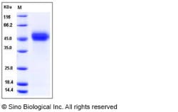 Sino Biological Recombinant Human uPAR/PLAUR Protein (His Tag), Quantity: