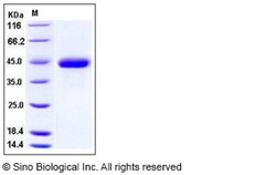 Sino Biological Human Osteonectin / SPARC Protein (His Tag) 100ug, Quantity: