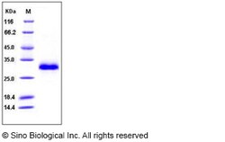 Sino Biological Recombinant Human TIMP-1 Protein (His Tag), Quantity: Each