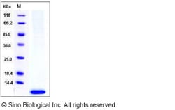 Sino Biological Human S100A6 / CACY Protein (His Tag) 50ug, Quantity: Each