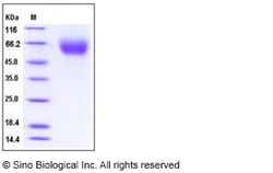 Sino Biological Recombinant Human IL-13 R alpha 1/IL13RA1 Protein (His