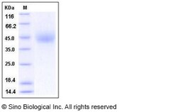 Sino Biological Human IL10Rb Protein (His Tag) 100ug, Quantity: Each of