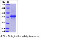 Sino Biological Recombinant Human Neuropeptide Y Protein (hFc Tag), Quantity: