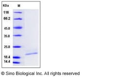 Sino Biological Recombinant Human IL-10 Protein (His Tag), Quantity: Each