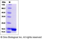 Sino Biological Human IL10 / Interleukin-10 Protein 100ug, Quantity: Each