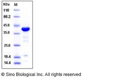 Sino Biological Human ACP1 / LMW-PTP Protein (GST Tag) 100ug, Quantity: