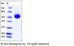 Sino Biological Recombinant Human Prostatic Acid Phosphatase/ACPP Protein
