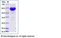 Sino Biological&nbsp;Human Serum Albumin / HSA / ALB Protein