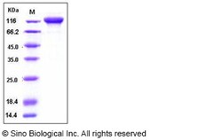 Sino Biological Recombinant Human gp130/IL6ST Protein (His & hFc Tag),