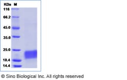 Sino Biological Recombinant Human CD3 epsilon/CD3e Protein (His Tag), HPLC-verified,