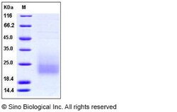 Sino Biological Recombinant Human CD3 delta/CD3D Protein (His Tag), HPLC-verified,