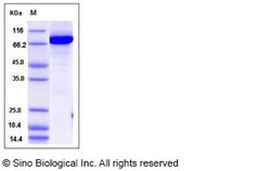 Sino Biological Recombinant Human NAMPT Protein (His & GST Tag), HPLC-verified,