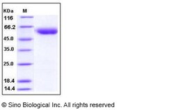 Sino Biological Human SerpinA7 / TBG Protein (His Tag) 50ug, Quantity: