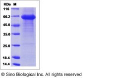 Sino Biological Recombinant Human Tomoregulin-1 Protein (ECD, hFc Tag),